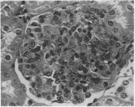 https://cdn.ncbi.nlm.nih.gov/pmc/blobs/4c1c/1503600/eb464f24d755/califmed00014-0025-a.jpg