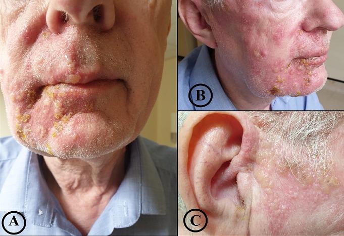 https://cdn.ncbi.nlm.nih.gov/pmc/blobs/4c24/7060913/d9ff0cde7f22/PAMJ-34-201-g001.jpg