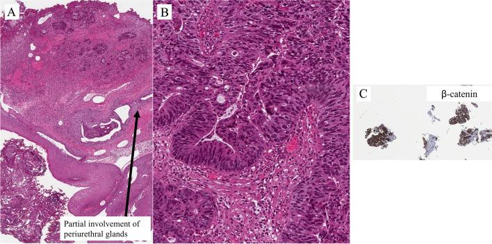 https://cdn.ncbi.nlm.nih.gov/pmc/blobs/4c25/10700461/31def3bbaea0/428_2023_3565_Fig18_HTML.jpg