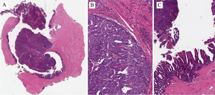 https://cdn.ncbi.nlm.nih.gov/pmc/blobs/4c25/10700461/5827fd9aaf33/428_2023_3565_Fig12_HTML.jpg