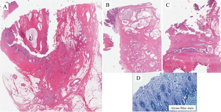 https://cdn.ncbi.nlm.nih.gov/pmc/blobs/4c25/10700461/c9246061675a/428_2023_3565_Fig13_HTML.jpg