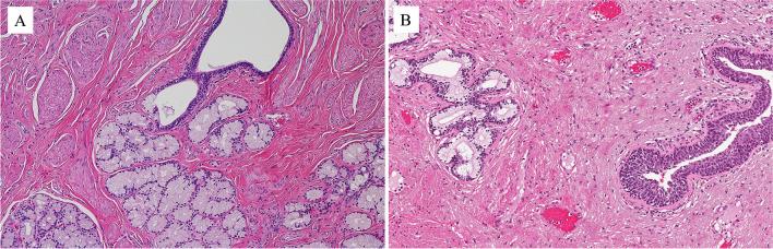 https://cdn.ncbi.nlm.nih.gov/pmc/blobs/4c25/10700461/f78fd637140f/428_2023_3565_Fig1_HTML.jpg