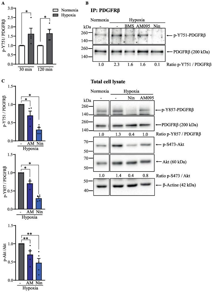 https://cdn.ncbi.nlm.nih.gov/pmc/blobs/4c2b/11240699/ae298656a690/cells-13-01152-g008.jpg