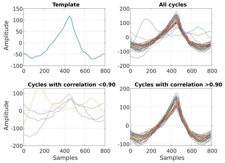 https://cdn.ncbi.nlm.nih.gov/pmc/blobs/4c35/10057625/fea757709638/sensors-23-03319-g005.jpg