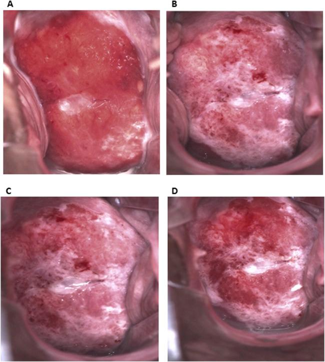 https://cdn.ncbi.nlm.nih.gov/pmc/blobs/4c35/12146208/240507263719/pore-31-1612076-g001.jpg