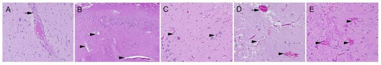 https://cdn.ncbi.nlm.nih.gov/pmc/blobs/4c3c/10743470/284d679ffea9/ijms-24-17266-g002.jpg