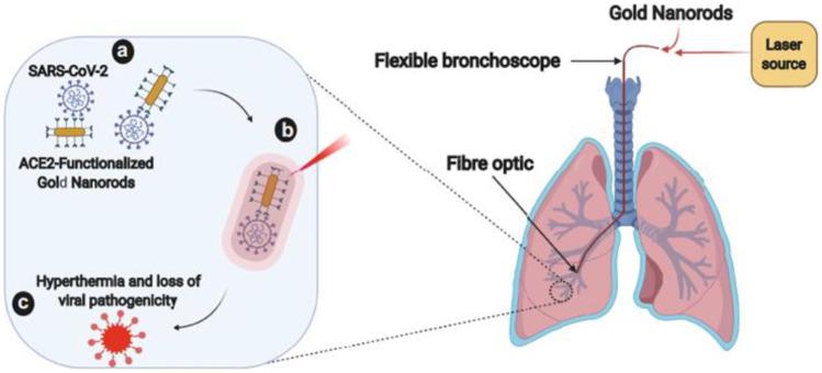 https://cdn.ncbi.nlm.nih.gov/pmc/blobs/4c41/9786532/45f459dbeb9a/11468_2022_1754_Fig17_HTML.jpg