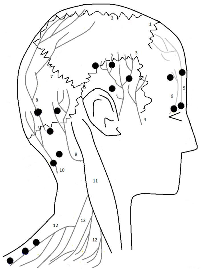 https://cdn.ncbi.nlm.nih.gov/pmc/blobs/4c42/9865956/37b5a425ee79/toxins-15-00059-g001.jpg