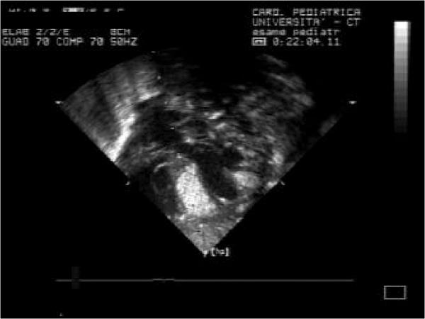 https://cdn.ncbi.nlm.nih.gov/pmc/blobs/4c44/4039990/63551aafc2e7/1471-2261-14-66-4.jpg