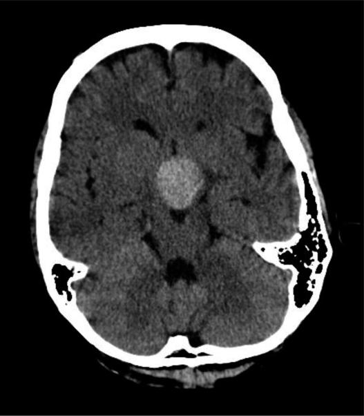 https://cdn.ncbi.nlm.nih.gov/pmc/blobs/4c45/2893763/9a09b6232b4e/opth-4-531f6.jpg