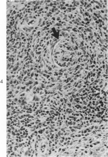 https://cdn.ncbi.nlm.nih.gov/pmc/blobs/4c4a/1949609/04fdc1f39052/amjpathol00324-0021-a.jpg