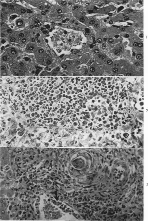 https://cdn.ncbi.nlm.nih.gov/pmc/blobs/4c4a/1949609/3e69ab650893/amjpathol00324-0019-a.jpg