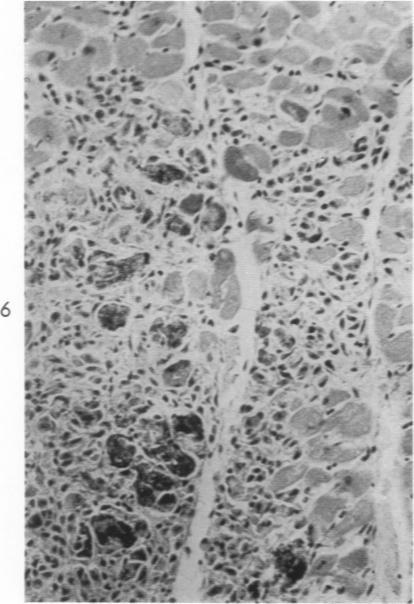 https://cdn.ncbi.nlm.nih.gov/pmc/blobs/4c4a/1949609/c1f6dd92b39e/amjpathol00324-0021-c.jpg