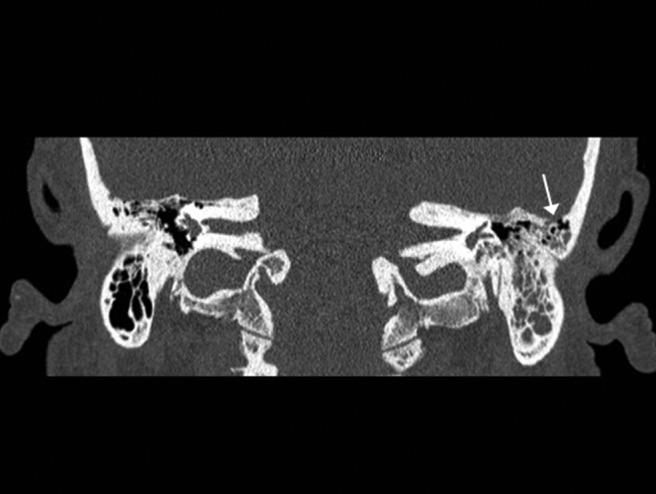https://cdn.ncbi.nlm.nih.gov/pmc/blobs/4c4a/5391488/7c77a82a15e1/arh0021501320002.jpg