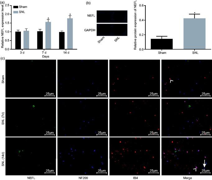 https://cdn.ncbi.nlm.nih.gov/pmc/blobs/4c4b/6537231/957834c4f589/10.1177_1744806919842464-fig1.jpg
