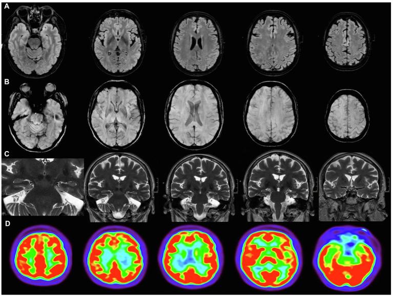 https://cdn.ncbi.nlm.nih.gov/pmc/blobs/4c4d/8599288/148138ccc6fe/fpsyg-12-724022-g001.jpg