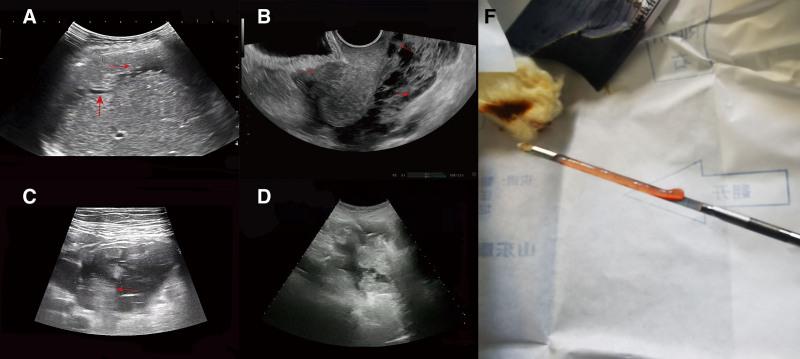 https://cdn.ncbi.nlm.nih.gov/pmc/blobs/4c5b/12039974/34b449ec0619/medi-104-e42298-g004.jpg