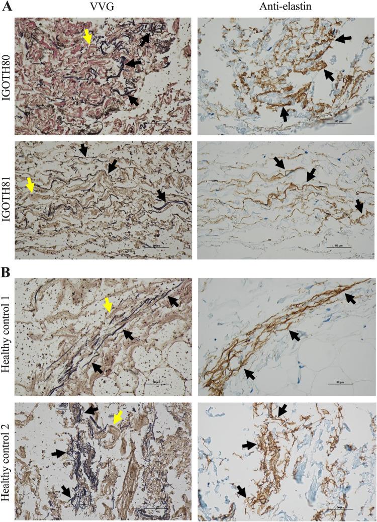 https://cdn.ncbi.nlm.nih.gov/pmc/blobs/4c5f/12266294/37cc2793e8bb/iovs-66-9-30-f002.jpg