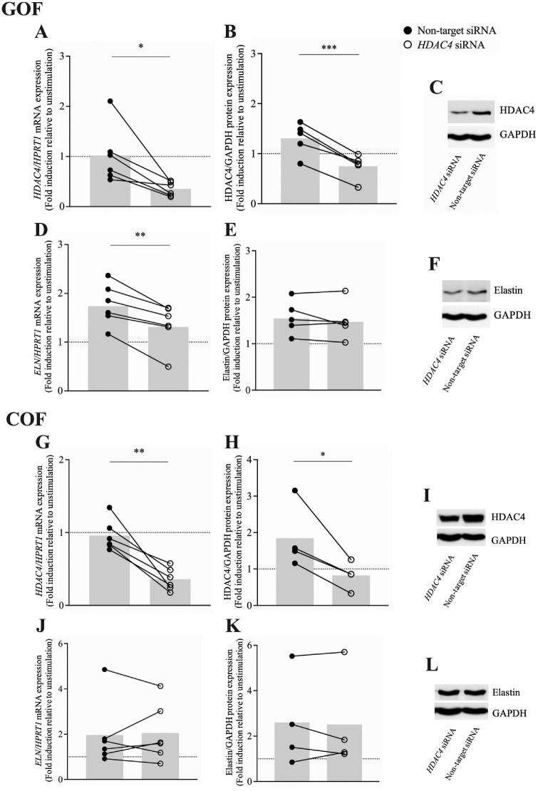 https://cdn.ncbi.nlm.nih.gov/pmc/blobs/4c5f/12266294/40184d712300/iovs-66-9-30-f004.jpg