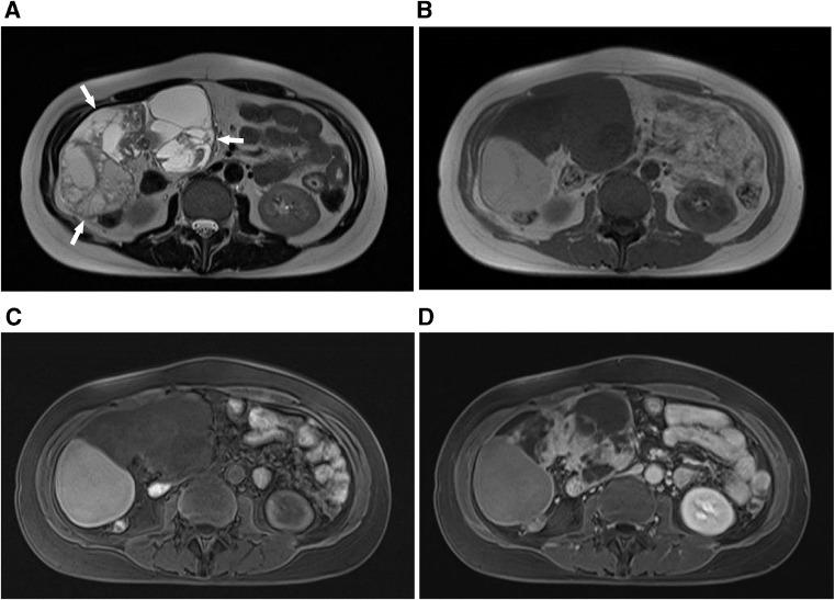https://cdn.ncbi.nlm.nih.gov/pmc/blobs/4c64/8237296/1a39fa4e6bad/gr1.jpg