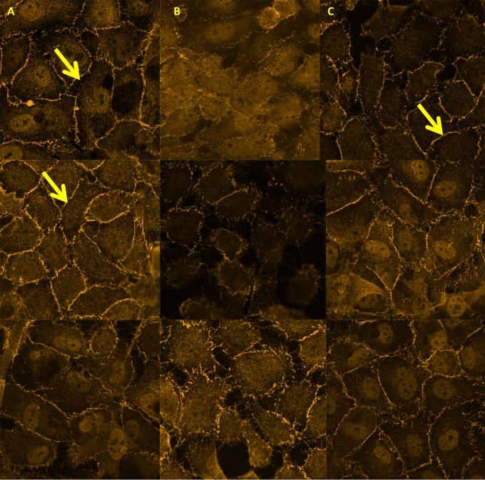 https://cdn.ncbi.nlm.nih.gov/pmc/blobs/4c65/4315531/18f87b458e56/pntd.0003459.g004.jpg