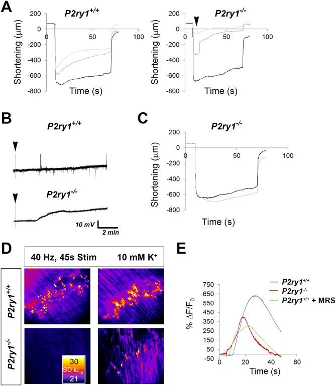 https://cdn.ncbi.nlm.nih.gov/pmc/blobs/4c68/5798932/475c5943ff9a/elife-30839-fig7.jpg