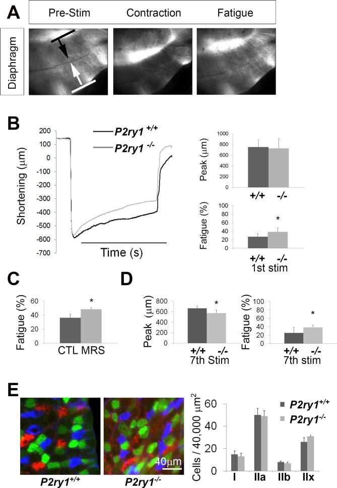 https://cdn.ncbi.nlm.nih.gov/pmc/blobs/4c68/5798932/72da9fc93de9/elife-30839-fig5.jpg