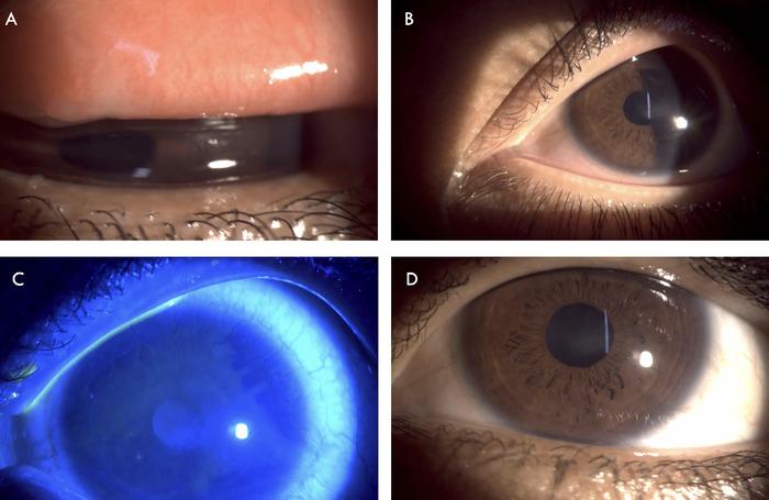 https://cdn.ncbi.nlm.nih.gov/pmc/blobs/4c6c/12175763/826dbe942df6/toj-24-0116-figure2.jpg