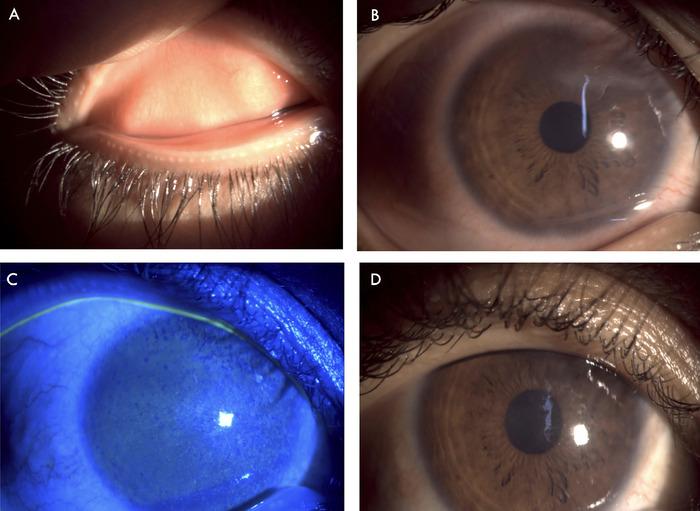 https://cdn.ncbi.nlm.nih.gov/pmc/blobs/4c6c/12175763/e2454ea85b16/toj-24-0116-figure3.jpg