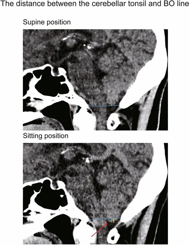 https://cdn.ncbi.nlm.nih.gov/pmc/blobs/4c70/7801697/97ac4f9d3438/41598_2020_79695_Fig3_HTML.jpg