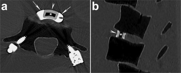 https://cdn.ncbi.nlm.nih.gov/pmc/blobs/4c76/8684547/32af1c02b6a9/10856_2021_6628_Fig2_HTML.jpg