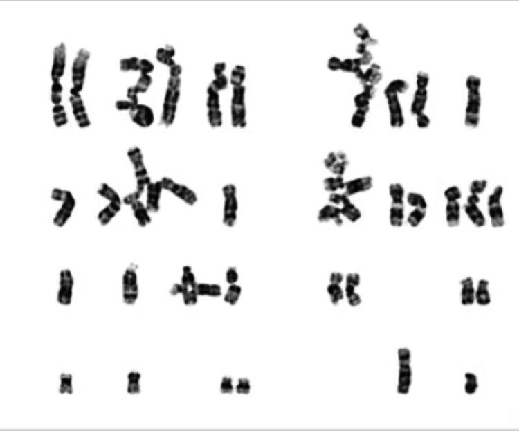 https://cdn.ncbi.nlm.nih.gov/pmc/blobs/4c7a/10257508/822313bcf2c7/cureus-0015-00000038899-i05.jpg