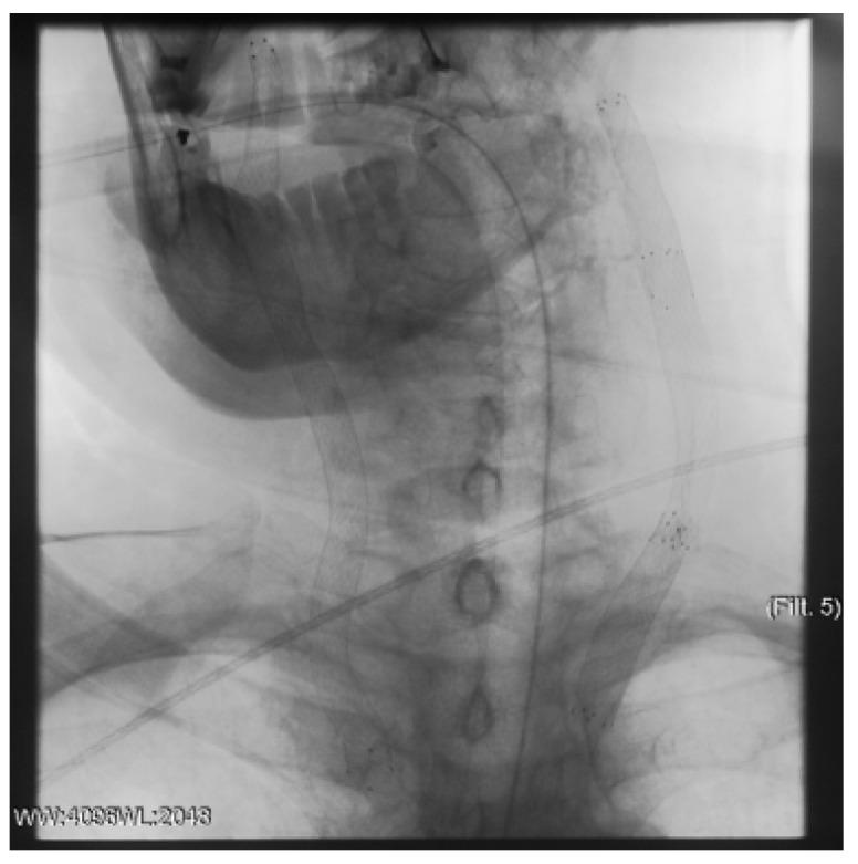 https://cdn.ncbi.nlm.nih.gov/pmc/blobs/4c7d/11084725/0539f20a9786/jcm-13-02716-g007.jpg