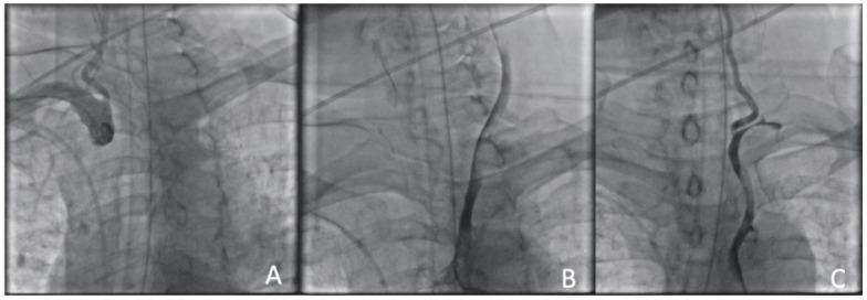 https://cdn.ncbi.nlm.nih.gov/pmc/blobs/4c7d/11084725/1121b8f0d31c/jcm-13-02716-g004.jpg