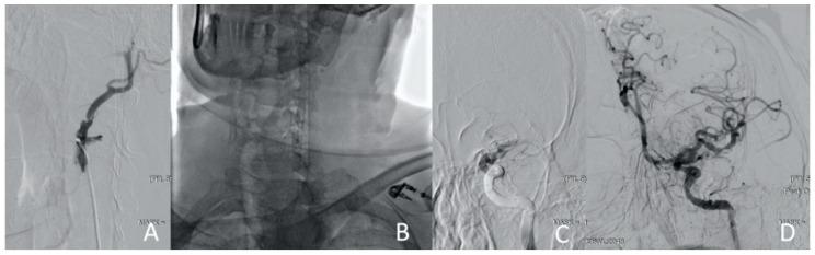 https://cdn.ncbi.nlm.nih.gov/pmc/blobs/4c7d/11084725/e5ada70803a6/jcm-13-02716-g011.jpg
