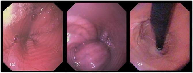 https://cdn.ncbi.nlm.nih.gov/pmc/blobs/4c82/8168026/c8de8d657d11/10.1177_2055116921994516-fig4.jpg