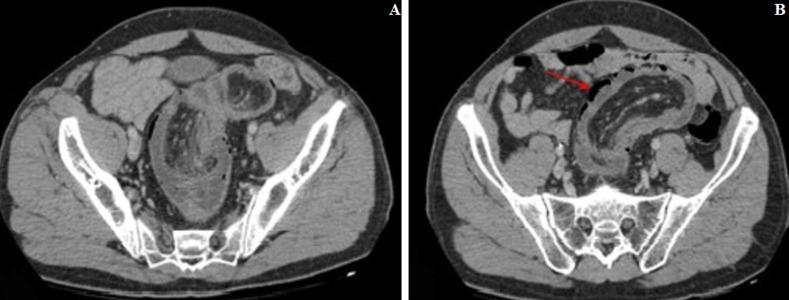 https://cdn.ncbi.nlm.nih.gov/pmc/blobs/4c86/7467618/c5a200c161f2/PAMJ-36-200-g002.jpg