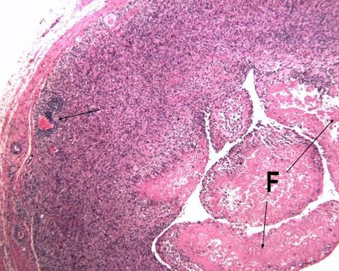 https://cdn.ncbi.nlm.nih.gov/pmc/blobs/4c8c/2919858/49f99c57d9ea/11999_2010_1372_Fig2_HTML.jpg