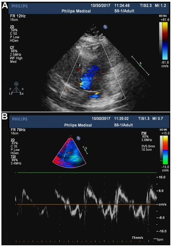 https://cdn.ncbi.nlm.nih.gov/pmc/blobs/4c8f/6307365/097ba34cd782/etm-17-01-0633-g01.jpg