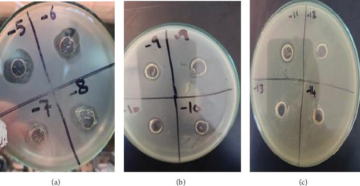 https://cdn.ncbi.nlm.nih.gov/pmc/blobs/4c90/12081149/2c178b5d53f1/IJMICRO2025-2072594.013.jpg