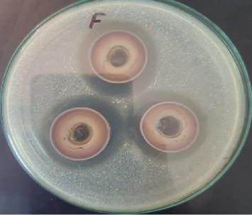 https://cdn.ncbi.nlm.nih.gov/pmc/blobs/4c90/12081149/c3d29ae86b79/IJMICRO2025-2072594.012.jpg