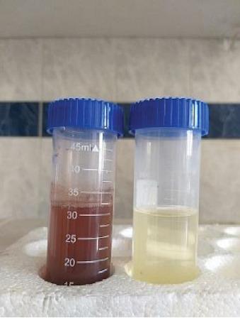 https://cdn.ncbi.nlm.nih.gov/pmc/blobs/4c90/12081149/f2bef2b9be49/IJMICRO2025-2072594.002.jpg