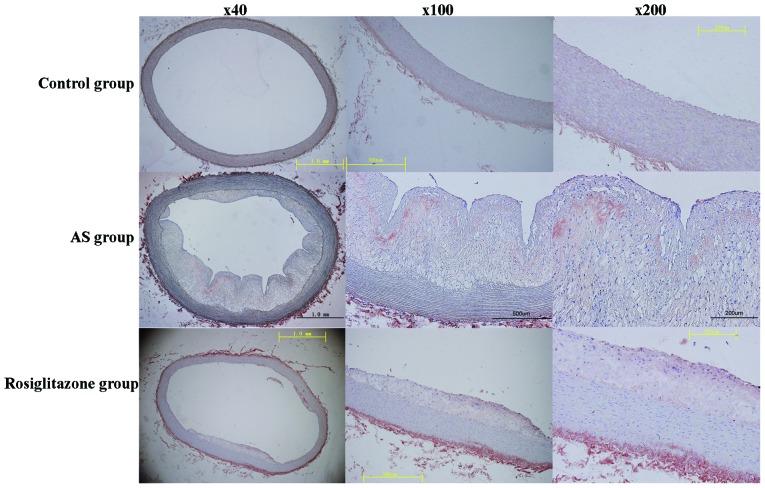 https://cdn.ncbi.nlm.nih.gov/pmc/blobs/4c90/4314417/ad884a6cfd80/IJMM-35-03-0715-g05.jpg