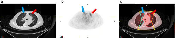 https://cdn.ncbi.nlm.nih.gov/pmc/blobs/4c99/9663684/fee734de049b/TCA-13-3114-g003.jpg