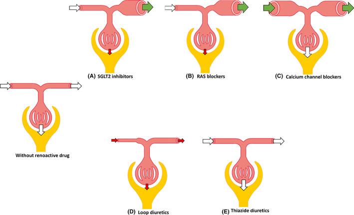 https://cdn.ncbi.nlm.nih.gov/pmc/blobs/4c9c/8048990/ae4722a591d4/NEP-26-377-g002.jpg
