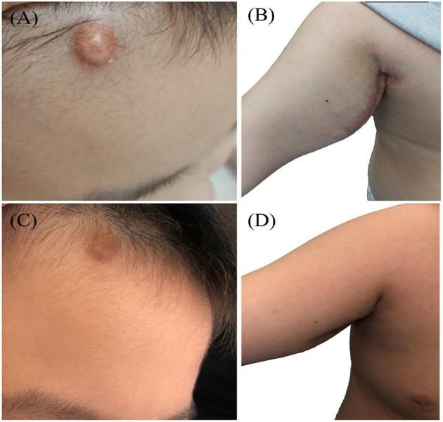 https://cdn.ncbi.nlm.nih.gov/pmc/blobs/4c9d/8222597/2fbdb0f4c219/fped-09-672547-g0001.jpg