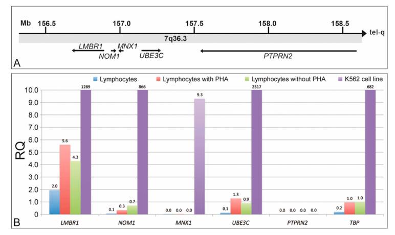 https://cdn.ncbi.nlm.nih.gov/pmc/blobs/4ca1/7956786/4575d62bd18e/ijms-22-02338-g001.jpg