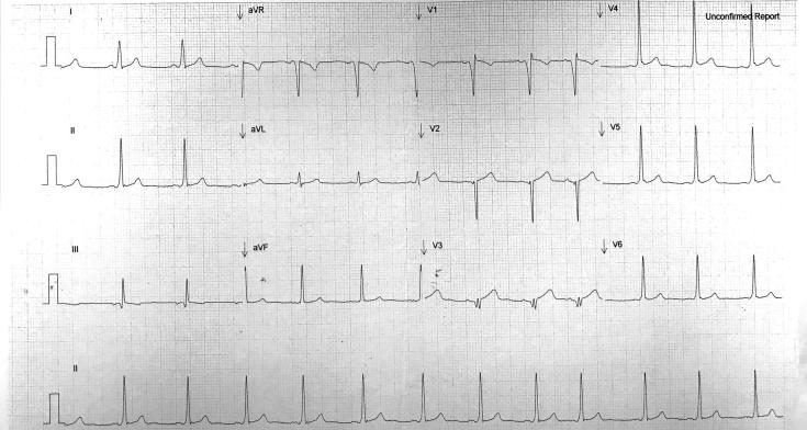 https://cdn.ncbi.nlm.nih.gov/pmc/blobs/4ca7/5511980/883ff69708ff/gr1.jpg