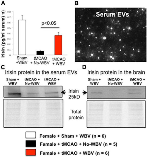https://cdn.ncbi.nlm.nih.gov/pmc/blobs/4ca7/9428155/d1ee60e61470/fnagi-14-942717-g006.jpg