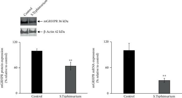 https://cdn.ncbi.nlm.nih.gov/pmc/blobs/4ca7/9873446/1c85363bd2fc/MI2023-2629262.005.jpg